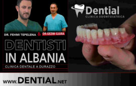Dentisti in Albania come scegliere la migliore clinica dentale