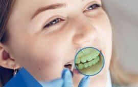 Dentista a Frascati il sorriso perfetto al Centro Odontoiatrico Ceccaioni