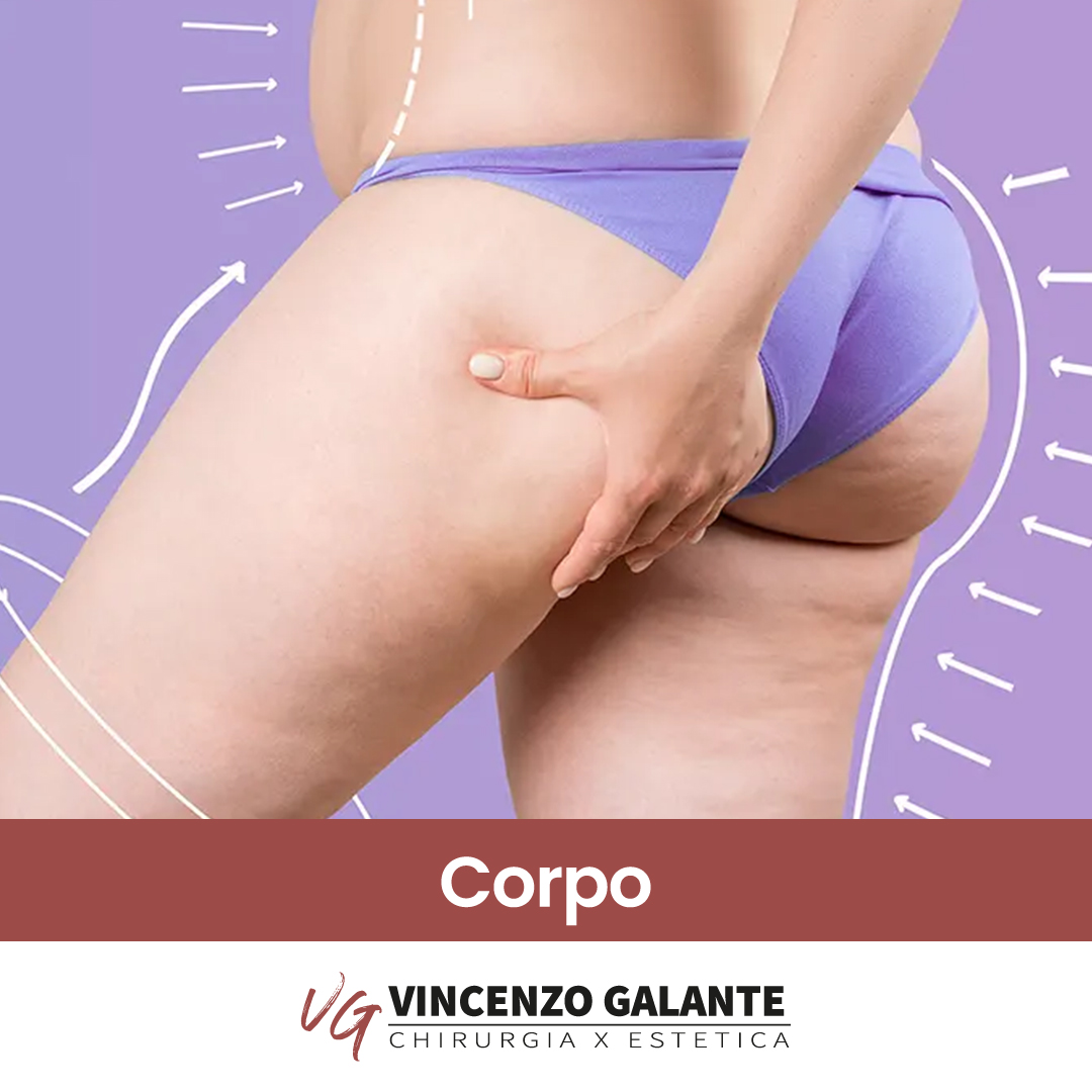 Liposcultura Riduzione Grasso Corporeo Dott. Vincenzo Galante a Roma Liposcultura per il rimodellamento della silhouette e per la Riduzione Grasso Corporeo