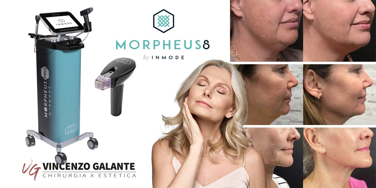 Morpheus8 a Roma Dott. Vincenzo Galante: tecnologia avanzata per viso e corpo. Negli ultimi anni la medicina estetica ha fatto passi da gigante, offrendo